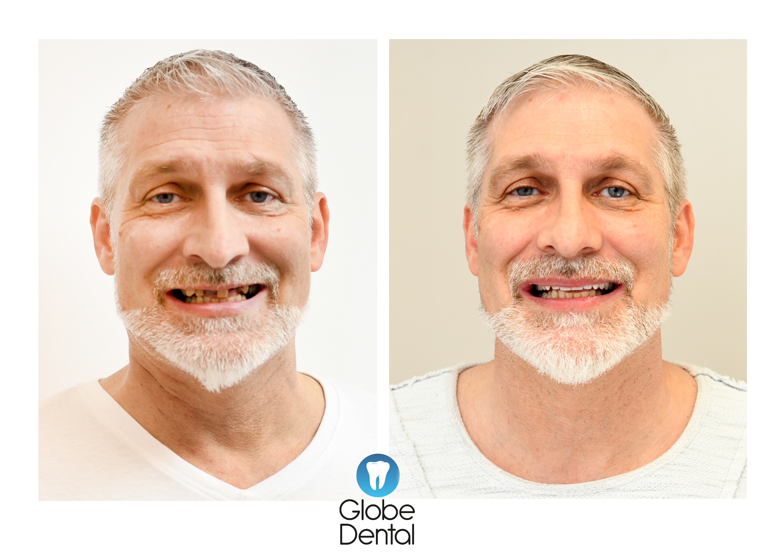 Páciens_Előtte_Utána