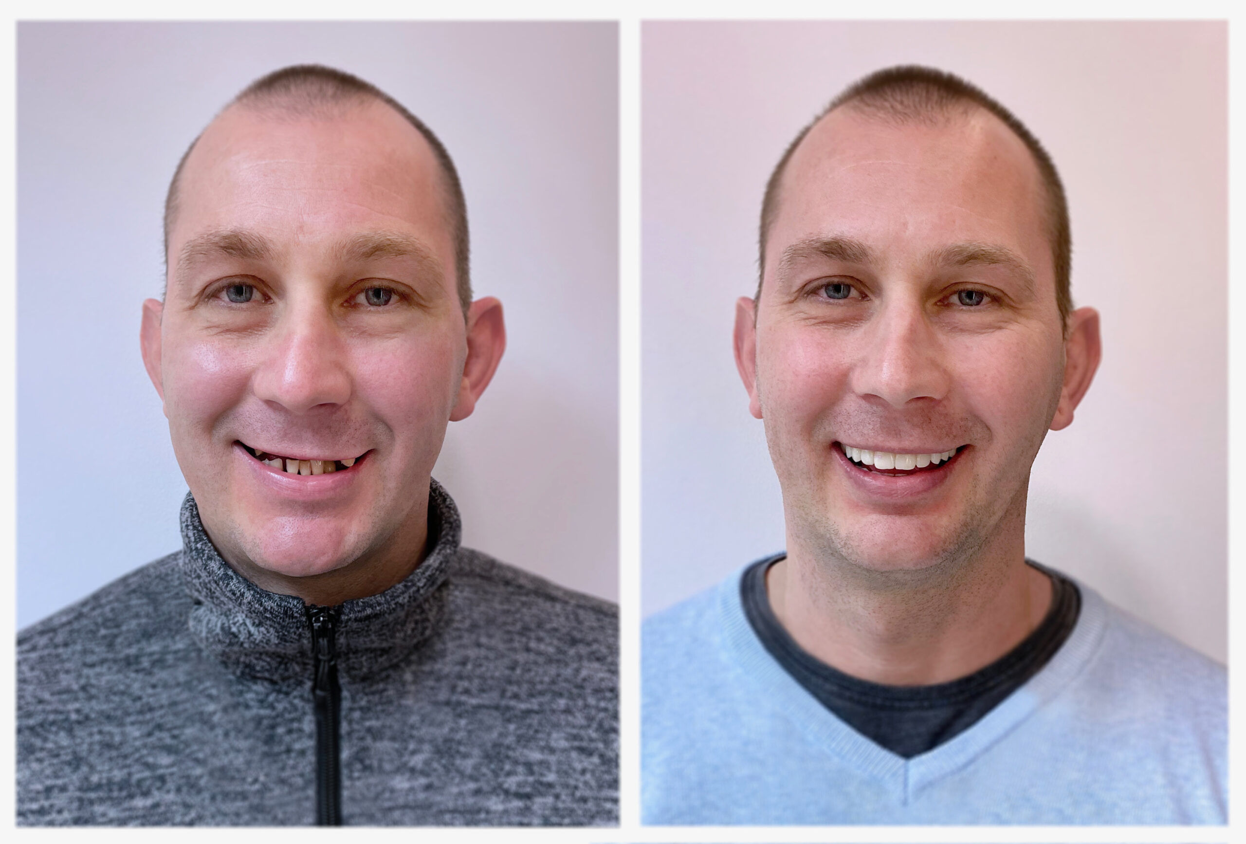 Sirok_Róbert_Előtte_Utána_1