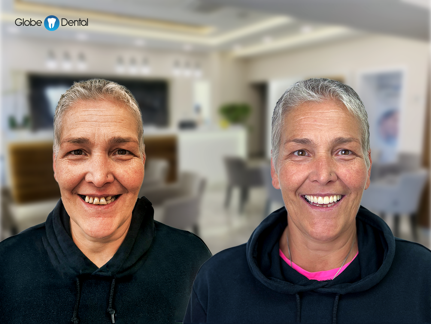 anita_elotte_utana (1)