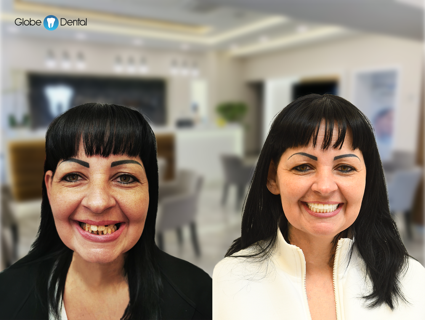 manuella_elotte_utana