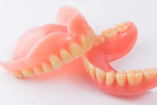 Kiveheto-hagyomanyos-fogsor-Removable-dentures-are-conventional.jpg