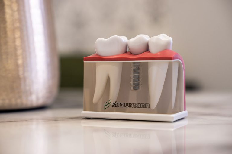 globedental-implantatum-straumann